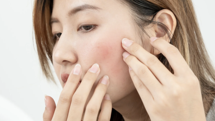 Same-Day Dermatology Care Near Dunkirk MD
